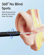 Smart Wireless Ear Cleaner with 1080P HD Camera - Visual Ear Wax Remover Tool